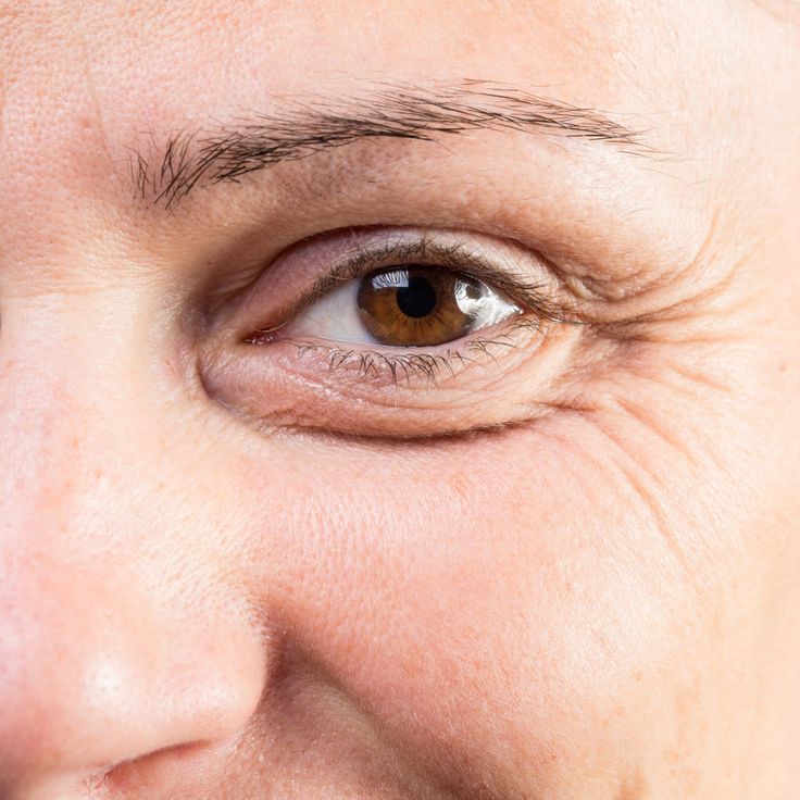 Eye Health Tips For Aging